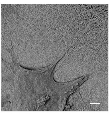 inra4
